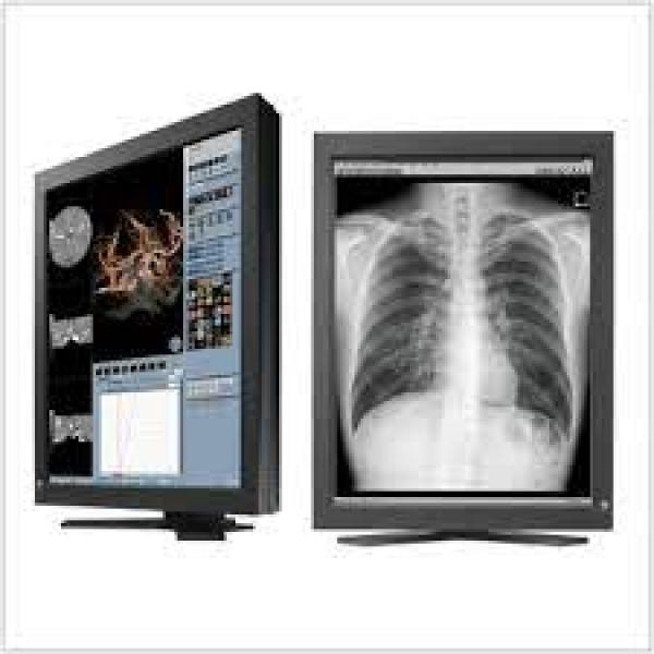 Monitor para RX Ecografias e Tomografias